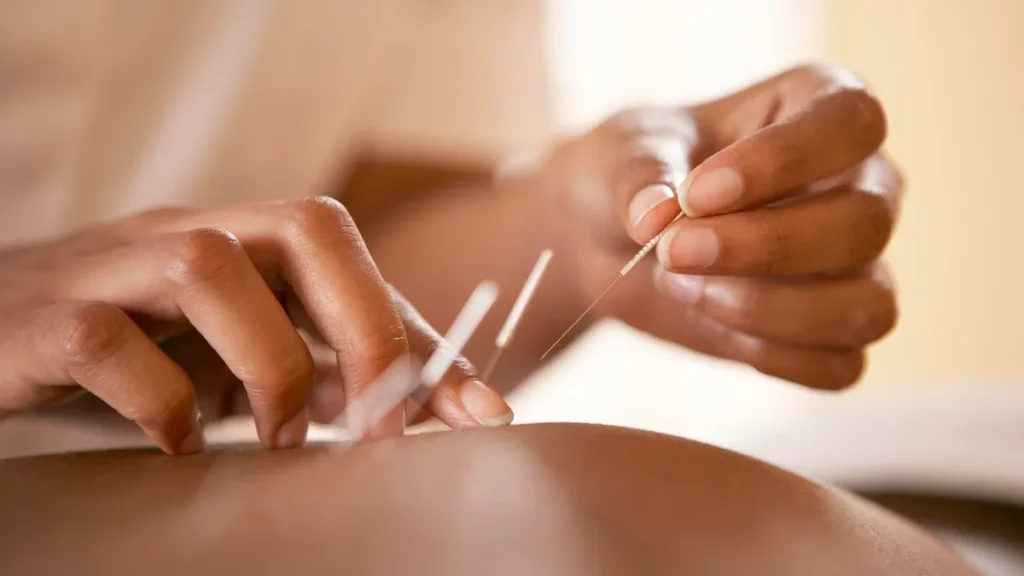 The woman's decision to try acupuncture on her back is important for her overall well-being.